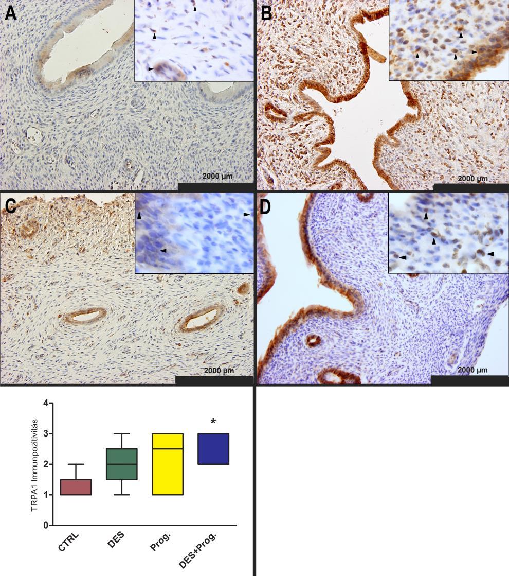 1.3. A TRPA1/V1 és MIF fehérje lokalizációja és hormonfüggő növekedése patkány endometriumban Kezeletlen 4 hetes állatokban minimális TRPA1 immunpozitivitás detektálható az epitél rétegben (17/A