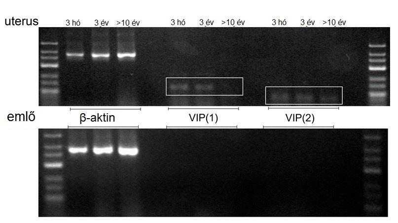 3.3. A VIP expressziójának vizsgálata juh emlőben, illetve plazma-és tejmintákban A vizsgált emlőmintákban a PACAP-pal rokon VIP peptid mrns expresszióját az alkalmazott primerek segítségével (1.