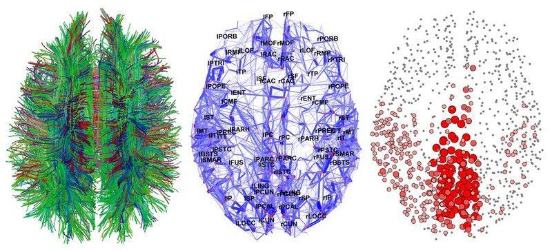Hagmann et al.