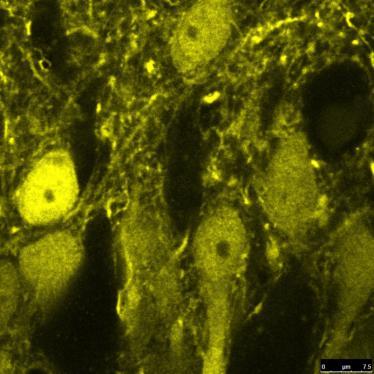 neuropeptidek kálcium-kötő fehérjék (calbindin, parvalbumin,