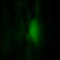 kisugárzott sárgászöld fluoreszcens fényt pedig egy a gerjesztő fényt elnyelő szűrőn keresztül érzékeltük. A felvételek hamis színezésűek. (A) Az YFP-LIP1 eloszlása fényben nőtt növényekben.