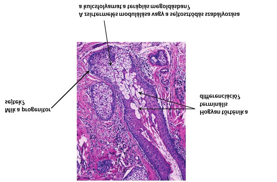 3.ábra Megválaszolatlan kérdések a faggyúmirigy kutatásban Valóban a zsíranyagcserét befolyásoló útvonalak/ transzkripciós faktorok jelentik a terápiás kulcsot?