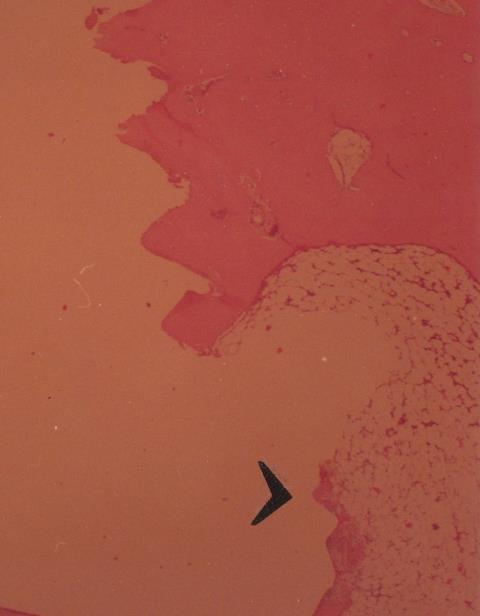 Eredmények In vitro
