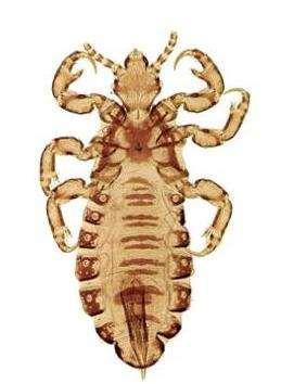 (Pediculosis)