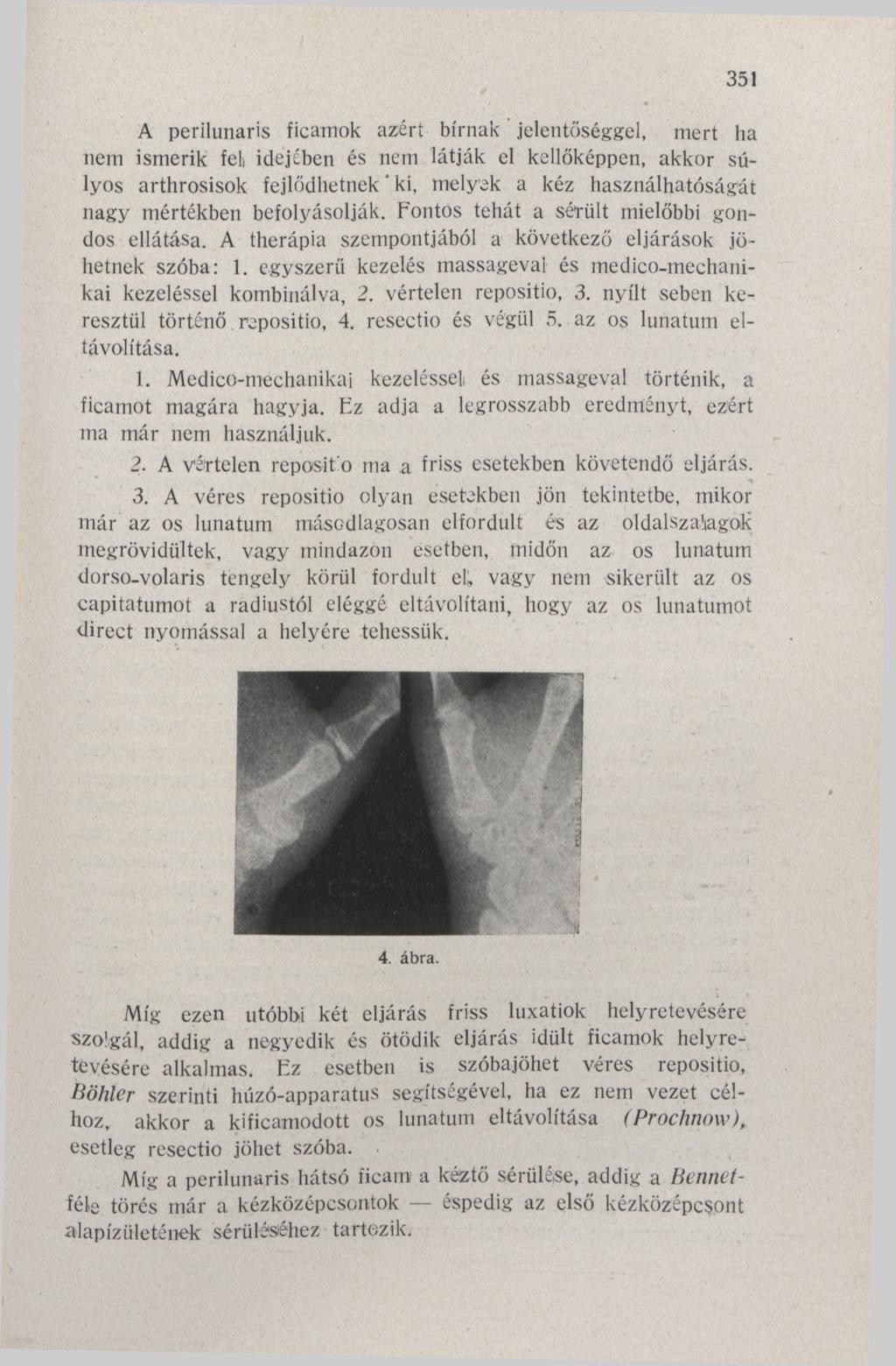 '351 A perilunaris ficamok azért bírnak jelentőséggel, mert ha nem ismerik fel, idejében és nem látják el kellőképpen, akkor súlyos arthrosisok fejlődhetnek' ki, melyek a kéz használhatóságát nagy