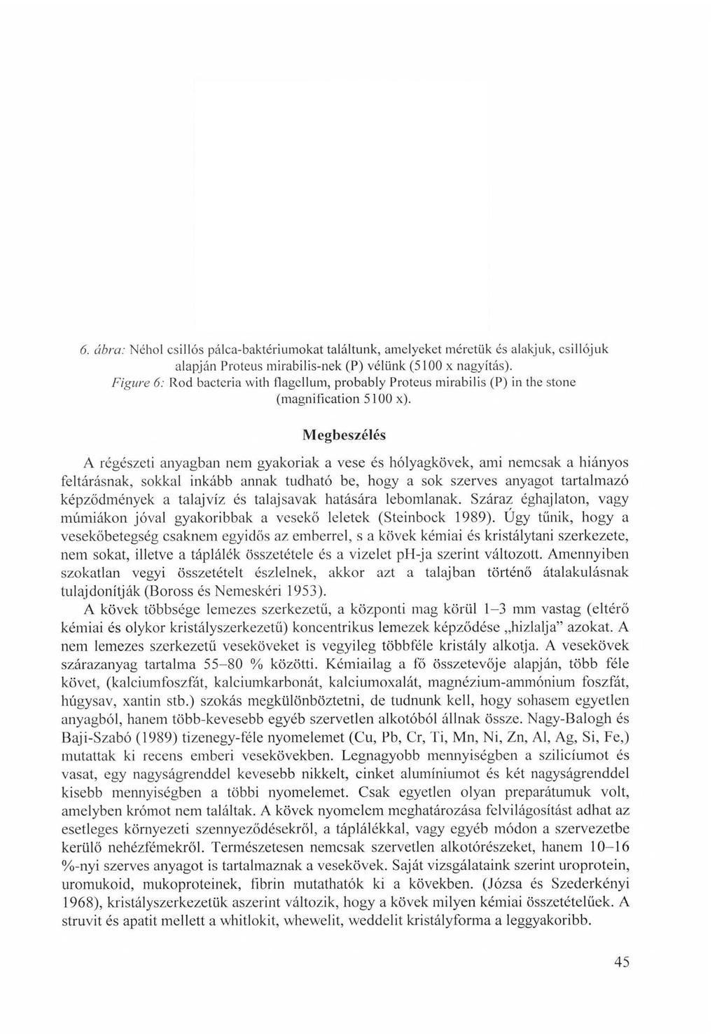 6. ábra: Néhol csillés pálca-baktériumokat találtunk, amelyeket méretük és alakjuk, csilléjük alapján Proteus mirabilis-nek (P) vélünk (5100 x nagyítás).