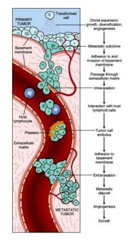 Intraepithelialis terjedés: lntraepithelialis LÉZIÓNAK hívjuk, a daganatsejtek jól elkülönülnek a morfológiájuk alapján, azonban még