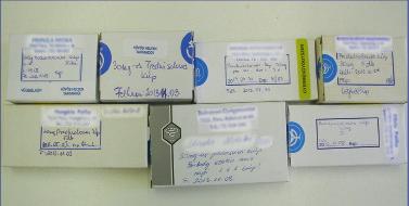 2013. július GYÓGYSZERÉSZET 401 Az organoleptikus és gyógyszertechnológiai vizsgálatok összefoglalása Vizsgálatok Eredmények Organoleptikus vizsgálatok Csomagolás 1 esetben háztartási alufólia Nem