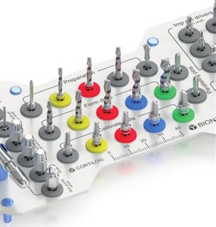 CORTILOG Implantátum Rendszer A CORTILOG rendszer