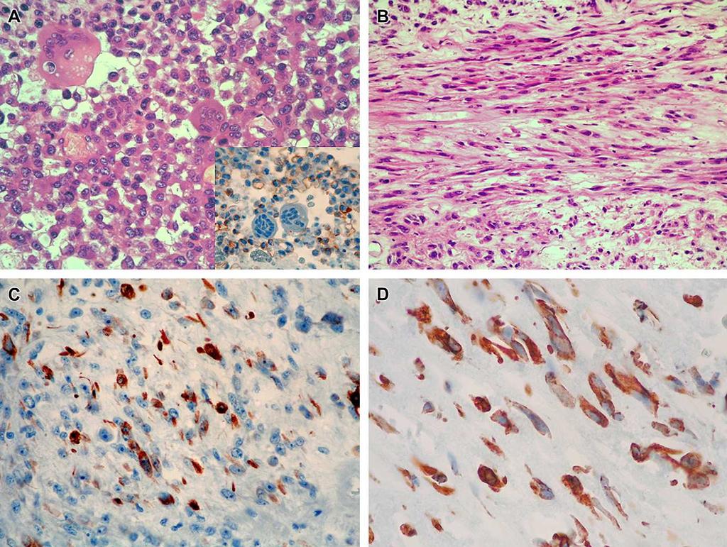 - 41 - lágyrészek myoepithelialis tumorai különböznek-e a nyálmirigyek és az emlő myoepitheliális tumoraitól a megegyező morfológiai és fenotípusos megjelenés ellenére, ami választ adhat az önálló