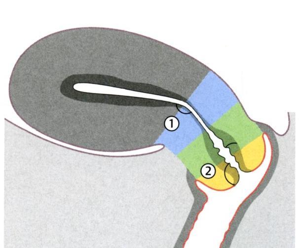 A corpus szürke, az isthmus kék, k, a cervix zöld és s sárga s színű a rajzon.