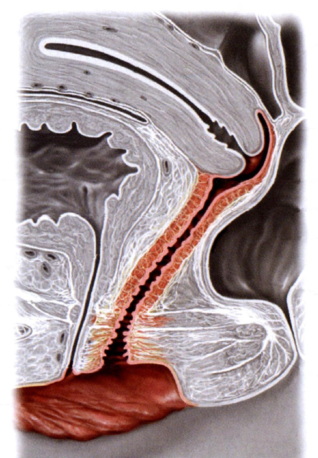 A hüvely h topográfi fiája: fundus vesicae, urethra, rectum, diaphragma urogenitale Excavatio rectouterina Vesicovaginalis septum Fundus vesicae Hátsó hüvelyboltozat