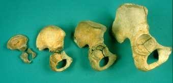 domináns T gén hatása érvényesül és here fejlődik, amely tesztoszteront termel. A nem makromorfológiailag XY esetben 6.hét után (13-15 mm-es embrio), az XX esetben a 12.