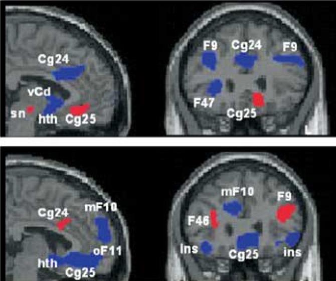 anatómiája DLPFC/OFC prefrontalis cortex