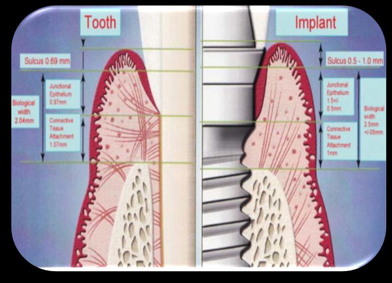 The soft tissue barrier at implants and teeth. Clinical oral implants research, 2(2), 81-90. Bennani, V., Schwass, D., & Chandler, N. (2008).