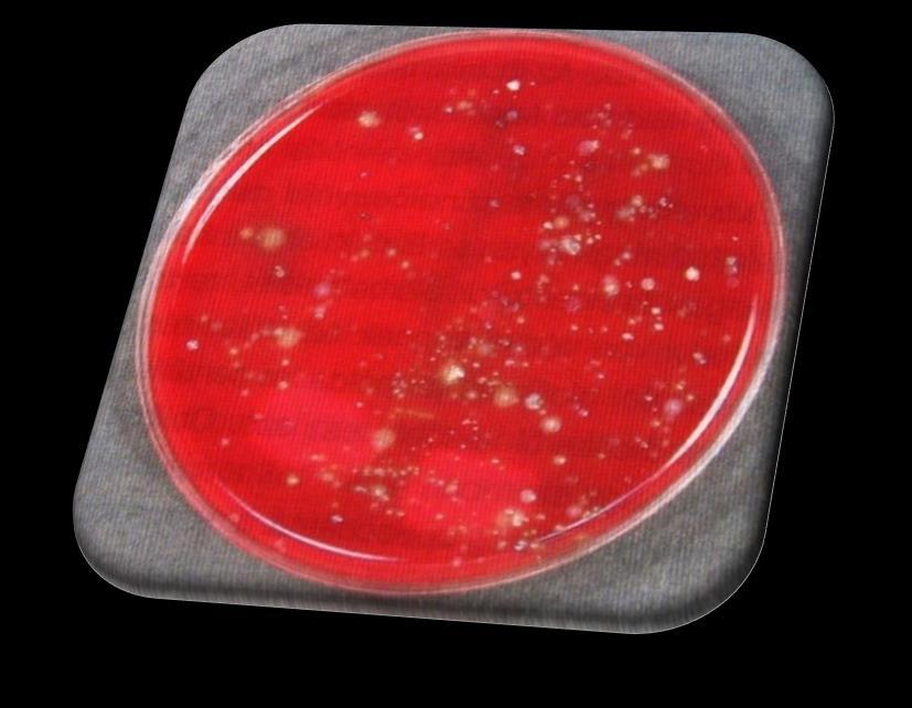 Hardie, J. M., & Bowden, G. H. (1974). The normal microbial flora of the mouth. In Society for Applied Bacteriology symposium series (Vol. 3, p. 47). Prof. Dr. Rozgonyi F, Dr. Barna Zs. (2011).