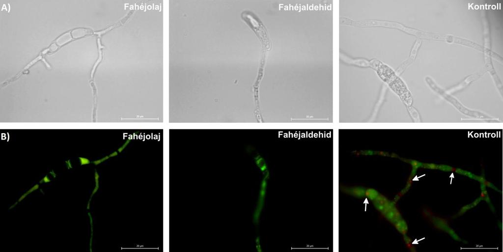 10. ábra: Az FSSC SZMC 21315 izolátum FUN1 fluoreszcens festékkel festett, kezeletlen, valamint 0,015-0,015 µl/ml fahéjolajjal, illetve fahéjaldehiddel kezelt csírázó konídiumai 16 óra, 25 C-on
