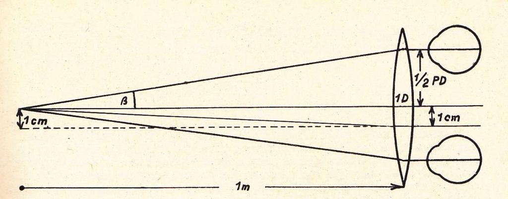 A decentrált lencse prizmatikus hatása PD pupilla distance β a konvergencia szöge ΔD prizmadiptria Ha egy lencsén nem