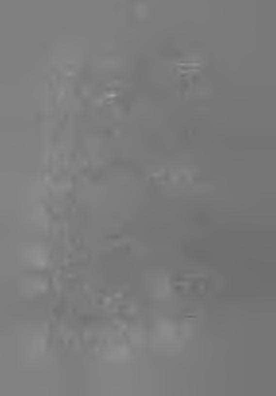 - U86 - C é r n a k e s z t y ű C hartpalc s z im b ó l u m o k C s a t l a k o z ó k / K o n t a k t a g y m. / Csem pe és m e t l a h i l a p o k C s ő m e m b r á n, r o z s d a m e n t e s 1977.