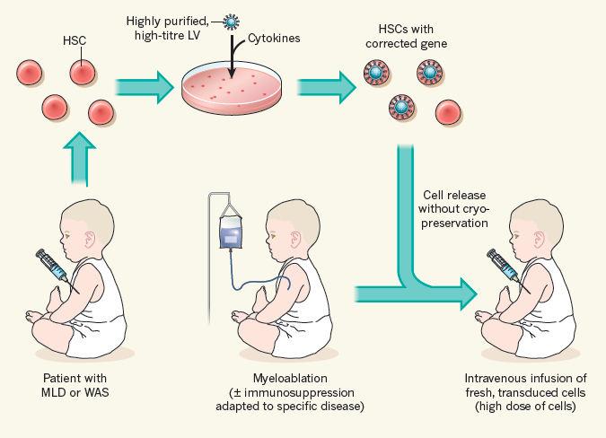 Gene therapy with autologous cord blood in genetic diseases Understand the biology of