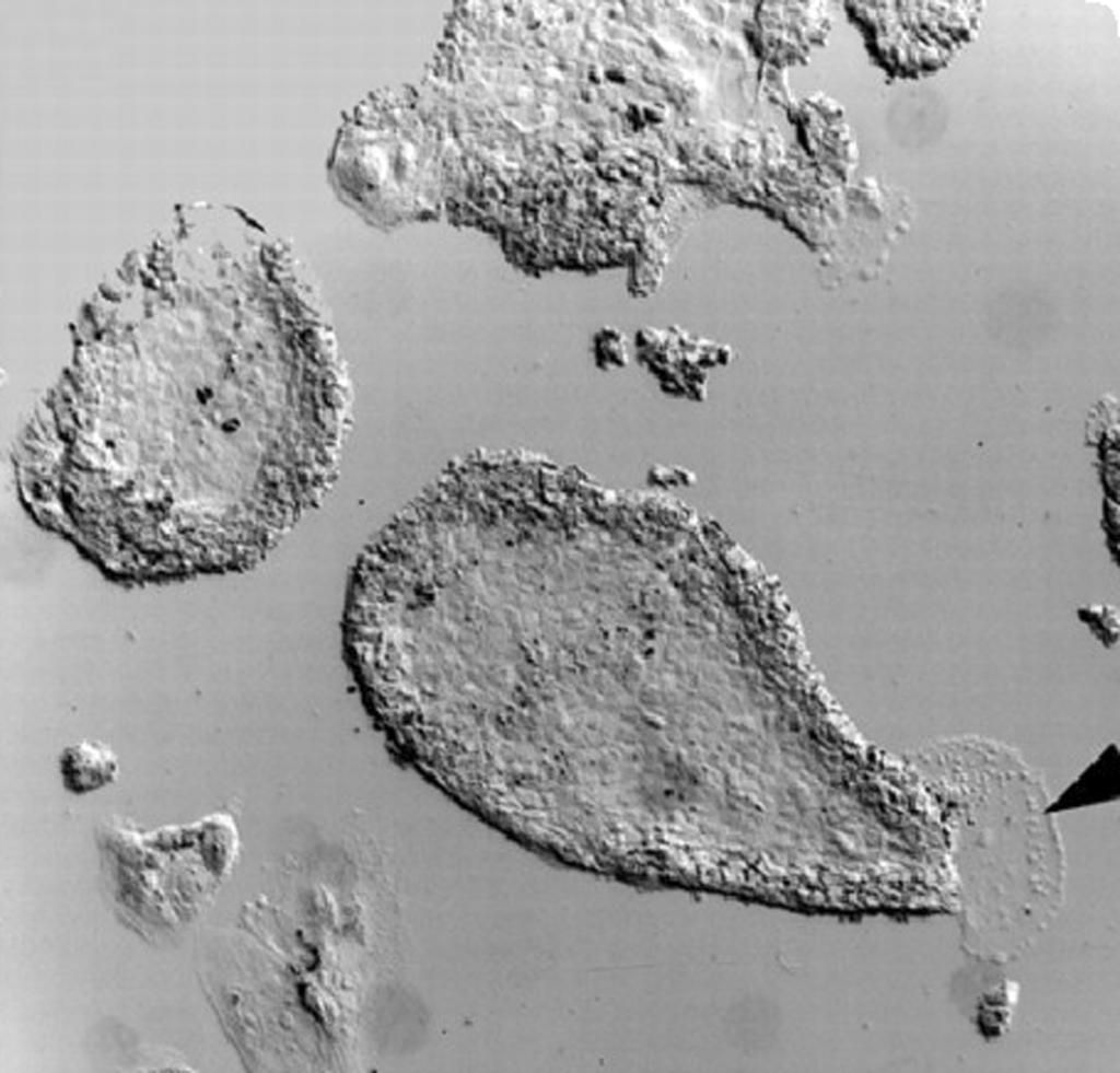 Gócza Elen Embrionális õssejtek és õssejt-vonalak kialakítani. Az így alapított sejtvonalakat pri mitív ektodermaszerû sejtvonalnak (Early Primitive Ectoderm Like EPL) nevezték el (Rathjen et al.