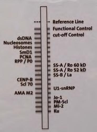 PM/DM, 6% JDM, 14-25% myositis overlap Anti-SSB 2-7% PM/DM, 4-12% myositis overlap CTD: Kötőszöveti betegség,