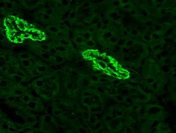 , Atlas of tissue autoantibodies) Parietális sejt elleni antitest (PCA): gyomor K + /Na + ATP-áz és alegysége