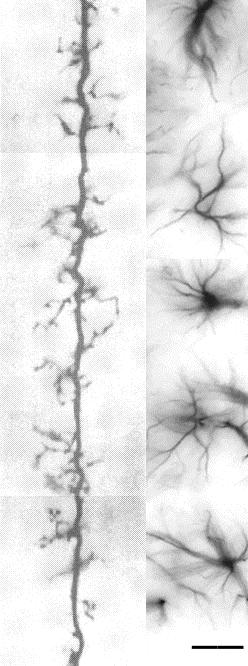 Bevezetés Az asztroglia funkciója: biztosítja a hátteret a neuronok működéséhez; GFAP (Glial Fibrillary Acidic Protein) expresszióra képes; Két típus: asztrociták és a radiális glia; -