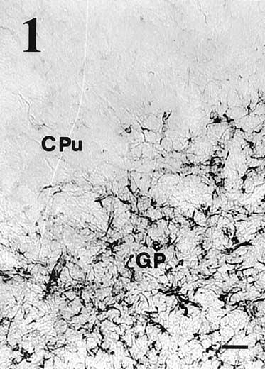 ábra PA - paleostriatum augmentatum PP primitivum, V - lateral ventricle Lépték: 50 µm.