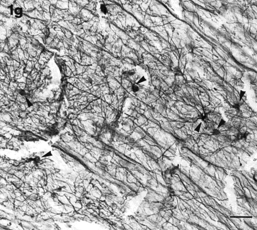A gliaszerkezet evolúciós tendenciái III. 5. ábra Caiman telencephalon.
