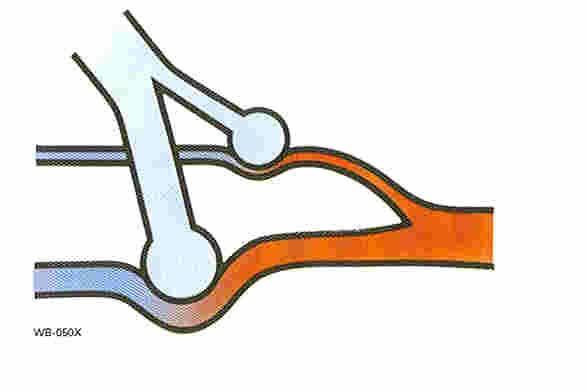 capillaris (atelect, consolid) postpulm (vv Thebesius,