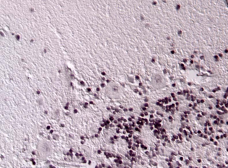 HCV by in situ hybridization in cerebellum 3. ábra 2.4. A különböző fixáló szerek hatását tekintve metodikai vizsgálatokat végeztünk az RNS integritásának megőrzésére.