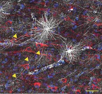 1. Interlaminar astrocytes tortuous