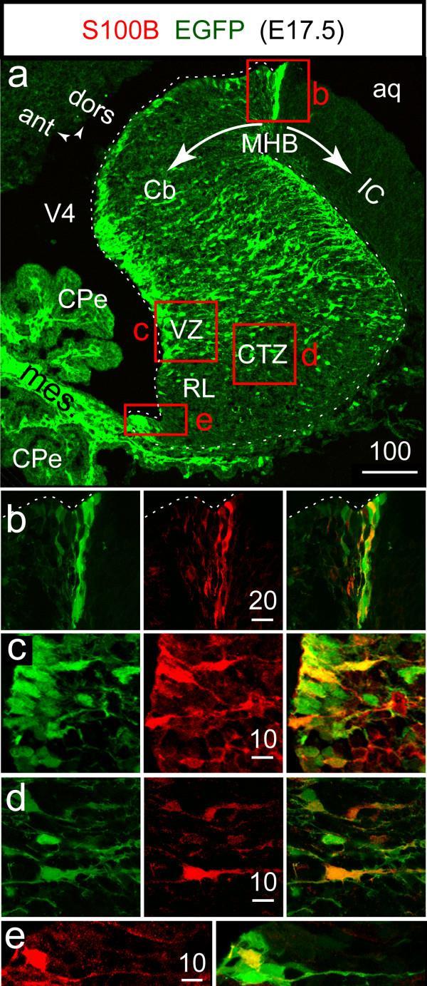 Hachem 2007 Radiális glia GFAP vimentin nestin (RC2 antigen) Nestin/BLBP Intermeder