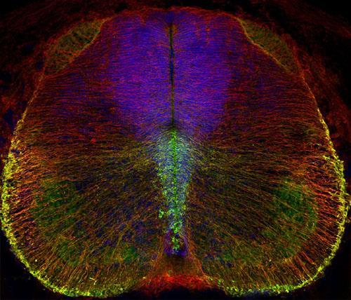 lee S100b Cerebellum, E17.5. A: parasagittal section of the cerebellar vermis.