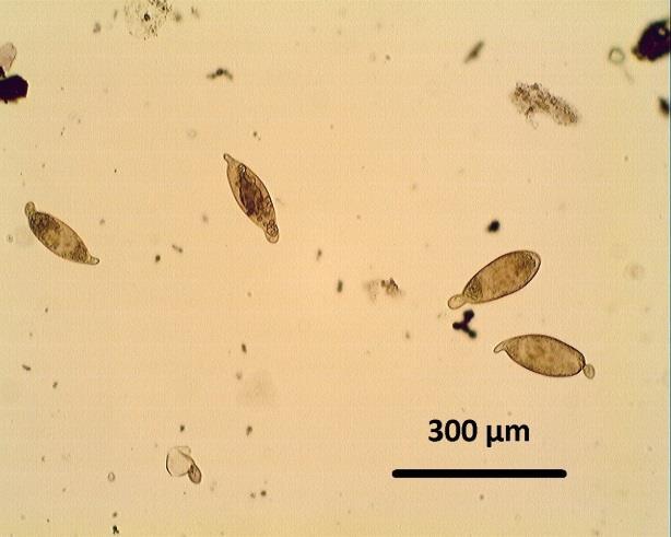5.2. A S. turkestanicum peték kimutatása a májból A S. turkestanicum féreg tartalmú májdarabok 50%-a tartalmazott vérmétely-petéket is.