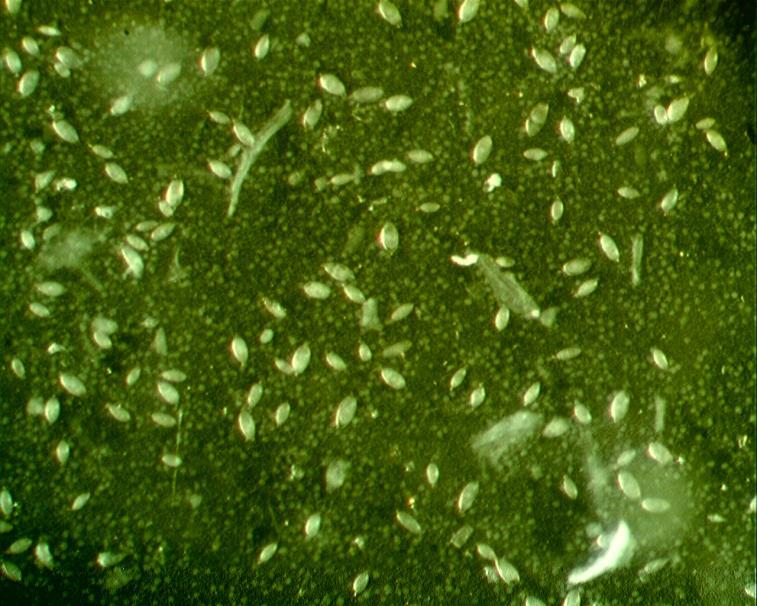 11. ábra: Natív S. turkestanicum peték a vízben szuszpendált máj sejtjei között. Az egyes peték nagysága elég változatos, ami a vérmételyekre általában jellemző.