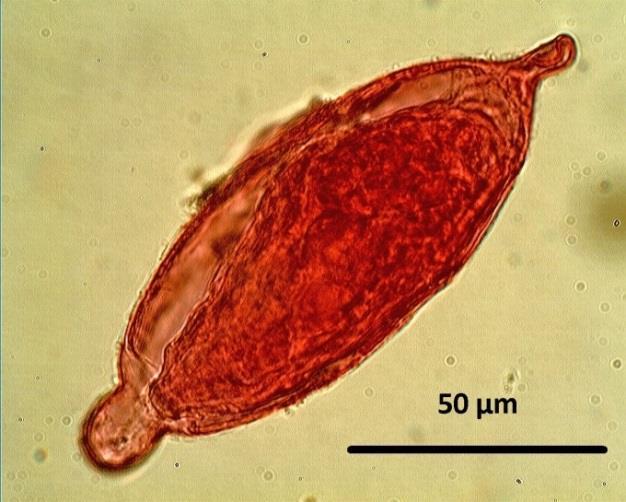 A fukszin élénkpirosra színezett néhány más, azokhoz hasonló nagyságú, bélsárban lévő képletet is, például a csillós egysejtűek cisztáit, egyes fonálféreg (pl.