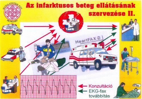 A területi Kardiológiai ellátás elve a Mona-System Egészségügyi Konzultációs Rendszerrel.