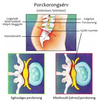BŐRIPARI EGÉSZSÉGI KOCKÁZATOK (1) Mozgásszervi rendellenességek kéz-kar inak gyulladásai, nyak-vállövi panaszok,