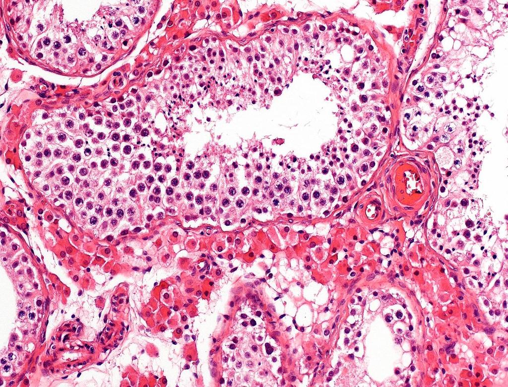 A herecsatorna és környezete: csírasejtek (spermatogonium,