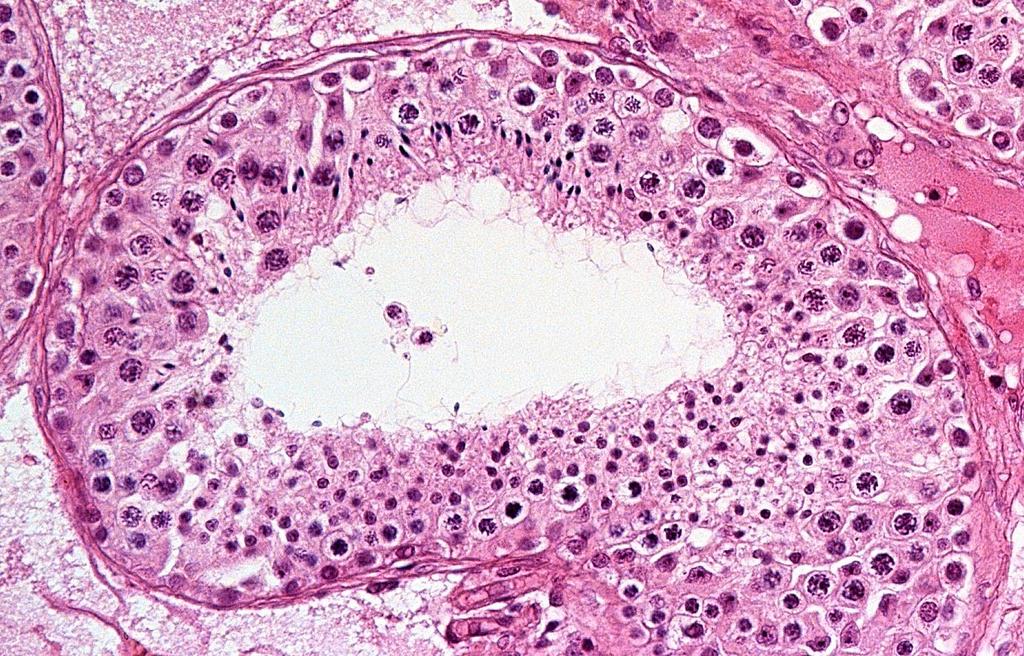 Normális spermiogenesis (korábban