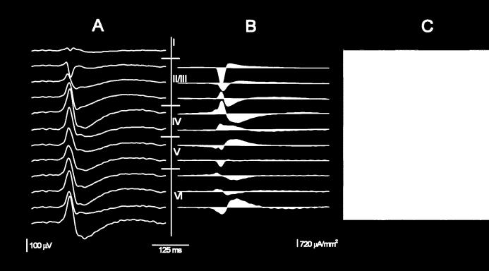 Agyi szinkronizációs alapmechanizmusok tanulmányozása Epileptikus