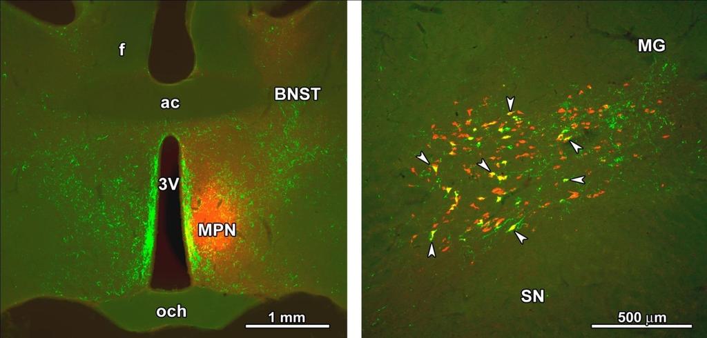jelölt TIP39 neuronok a PIL-ben pil preoptikus terület (median preoptic nucleus MPN) bed