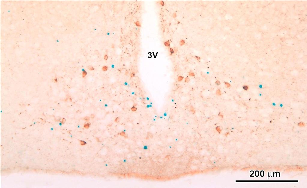 Parathormon 2 (PTH2) receptort expresszáló sejtek tuberoinfundibular peptide(tip-39)-re is érzékeny