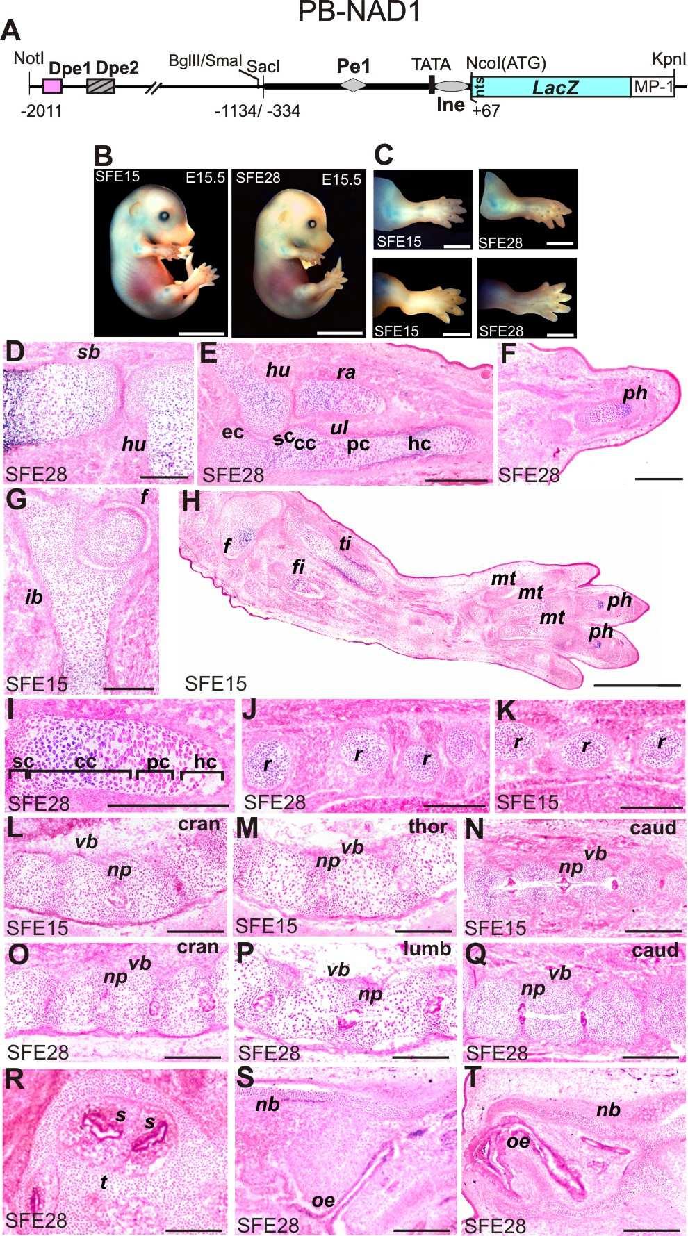 8. ábra A távoli promoter elemek növelik a Matn-1 rövid promoter aktivitását in vivo.