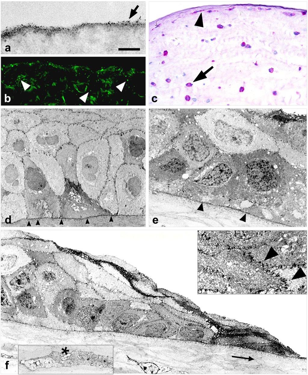 53 Hat órával az abláció után a stromális felszínt molekuláris törmelék, un. pseudomembrán fedte (17a. ábra).