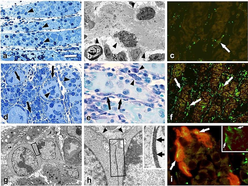 65 Gap junction csatornák notexin-kezelt regenerálódó patány soleus izomban Az izomkárosodás és a gyulladásos reakció mértéke notexin injekció után arányos volt a toxin koncentrációjával, ezért a