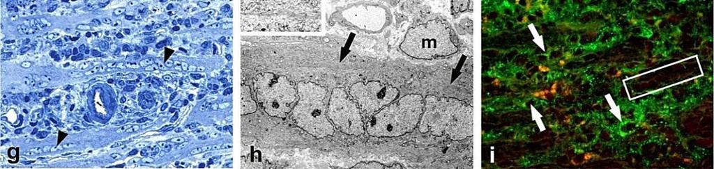 immunfluoreszcens reakciója (zöld) (b); Cx43 (zöld) és desmin (piros) kolokalizációja (nyilak) myogenikus sejtekben (c); az erőteljes és egyenletes p21 waf1 (d) és p27 kip1 (e) immunreakció és