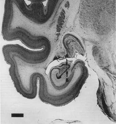 fordul így ér a gyrus dentatushoz itt fimbria hippocampi távozó rostok - ezek később a fornixba, majd ezen